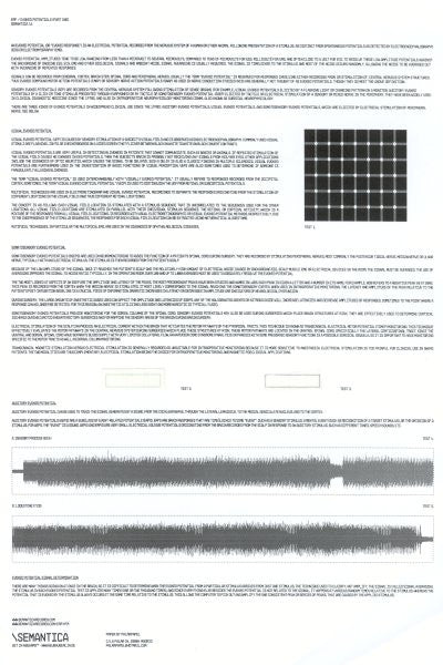 E.R.P. : Evoked Potentials (Part One) (10", Ltd, W/Lbl, Tra)